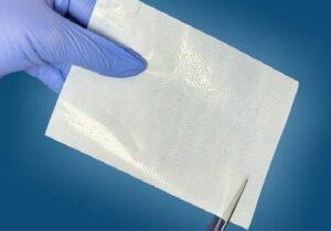 درمان زخم با زخم‌پوش فوق‌نازک هوشمند و صرفه‌جویی یک میلیون دلاری