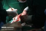 تشریح مهم ترین چالش های پیوند ریه در ایران